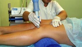 Polven nivelfysioterapia